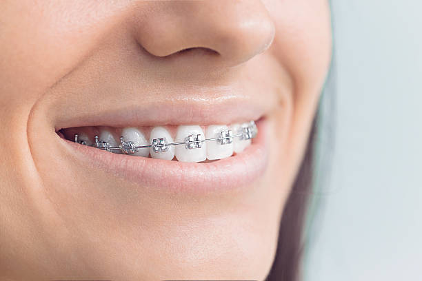 Best Teeth Whitening  in Silver Lake, OH